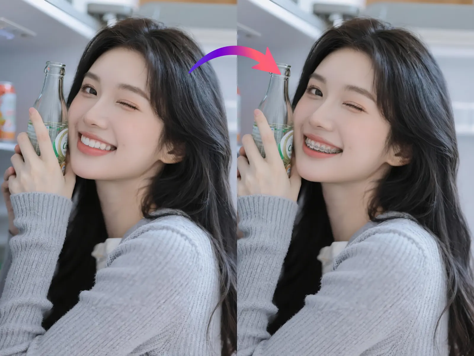 braces filter online