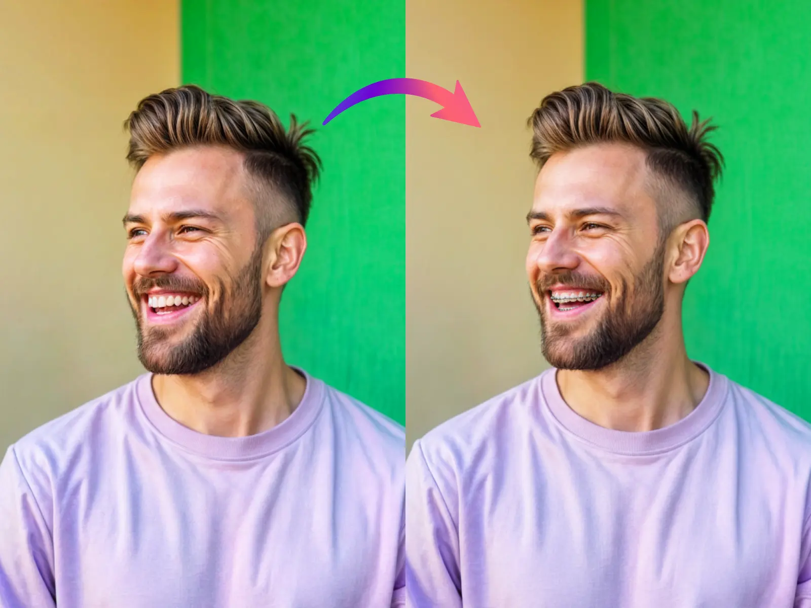 try on braces filter