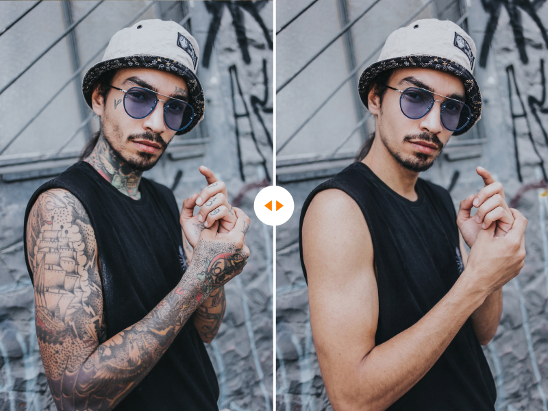 AI tattoo remover showcase